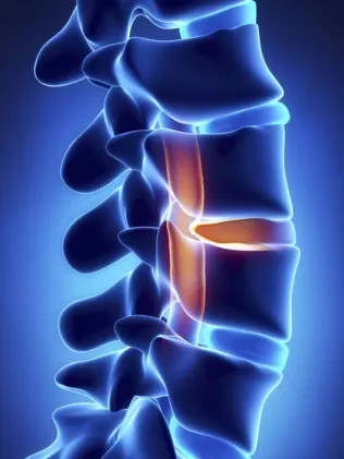 脊髓损伤的主要功能障碍都有哪些？