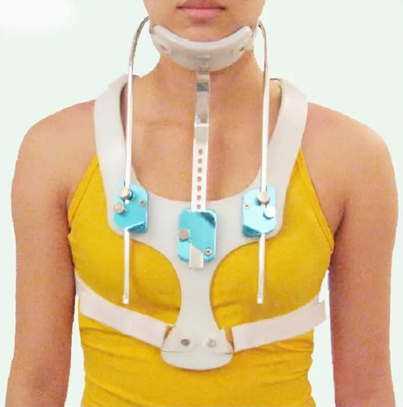 颈胸矫形器的应用