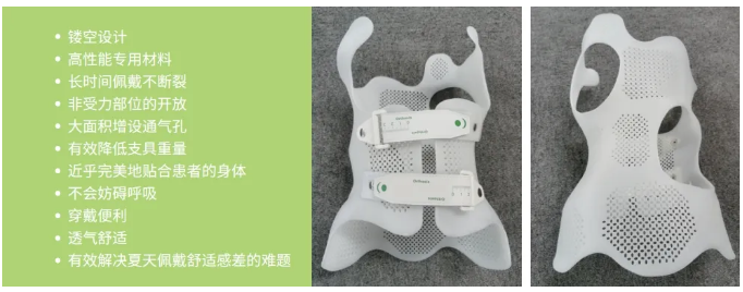 传统脊柱侧弯支具与3D打印矫形支具的区别  