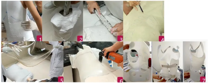 传统脊柱侧弯支具与3D打印矫形支具的区别  