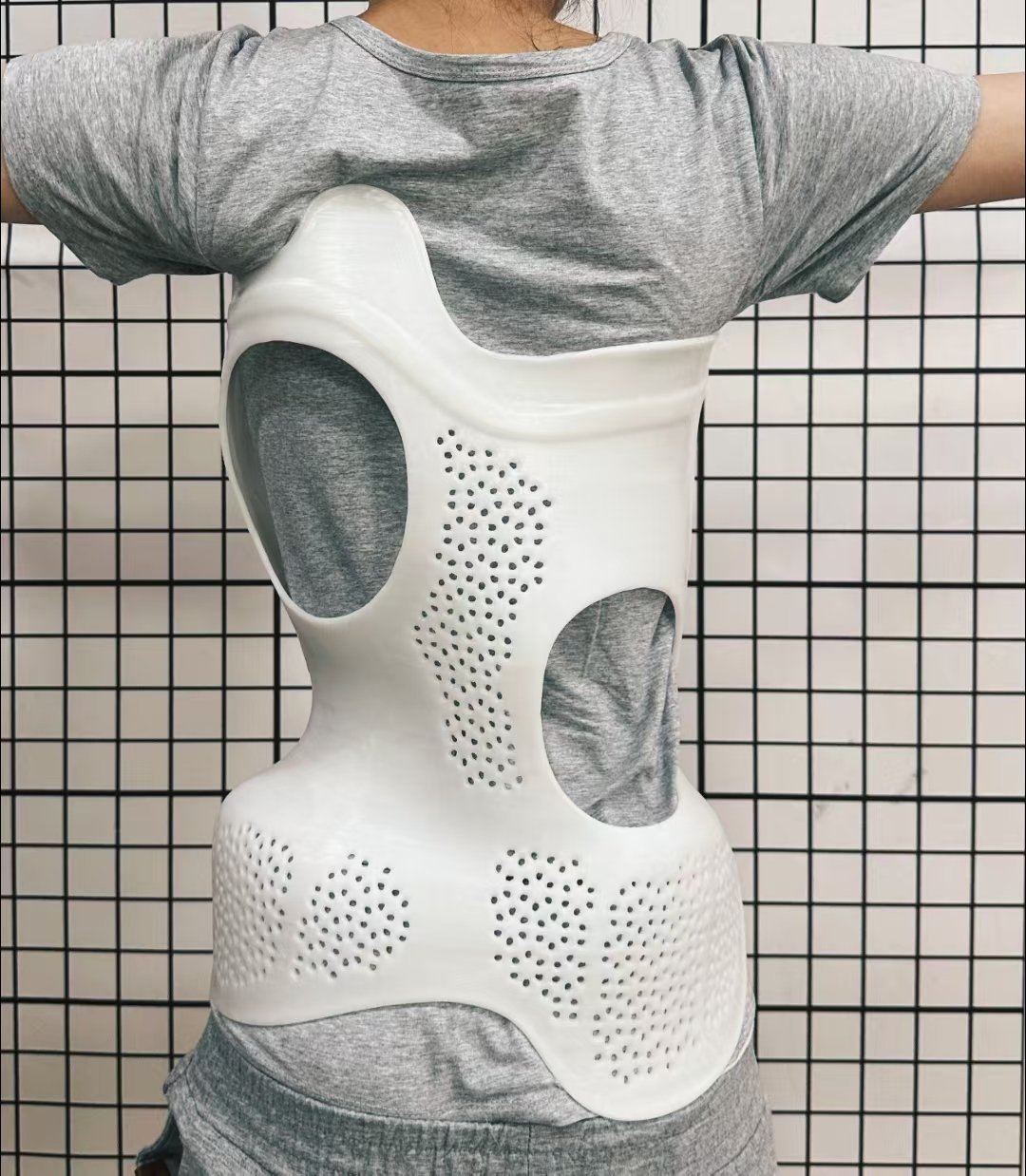 脊柱侧弯支具穿戴3个月要及时复查