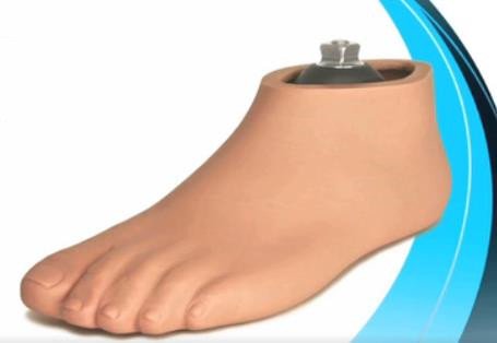 微型切片技术碳纤储能假脚